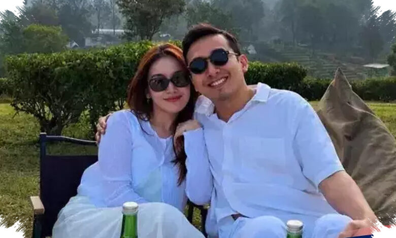 Ayu Ting Ting Temani Kevin Gunadi Operasi Kecil, Bantah Aura Wajahnya Berubah