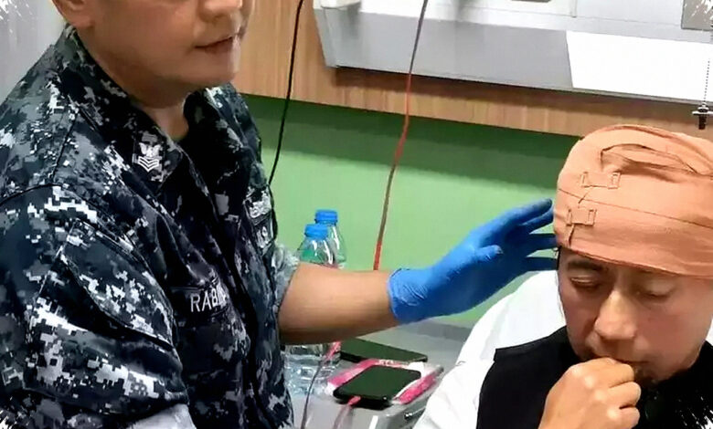 Usai Ditabrak di Bandung, Kepala Yuki Pas Band Harus Dijahit 10 Kali